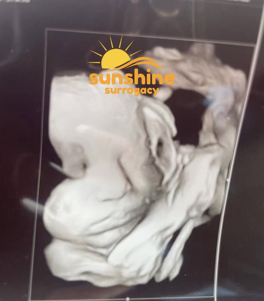 Celebrating New Life at 37 Weeks